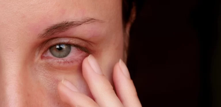 Eye Irritation